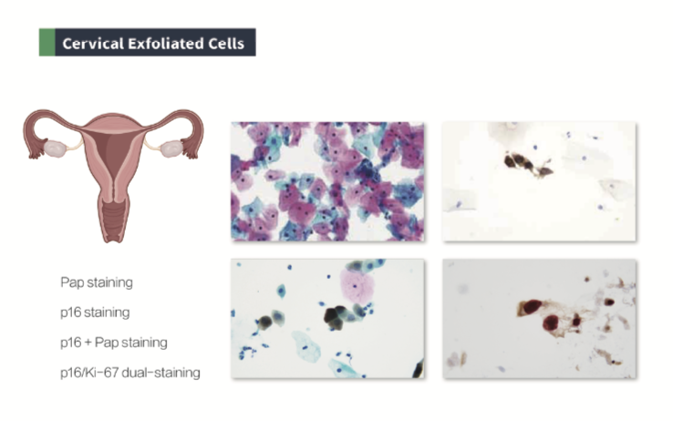 CNT 480 Fully Automatic Liquid-Based Cytology &Immunocytochemistry Stainer