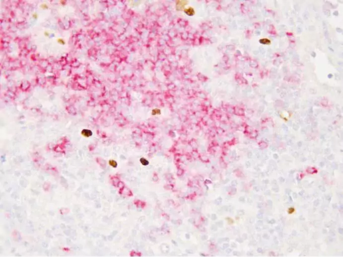 EBER Probe for Accurate EBV Identification in Cells