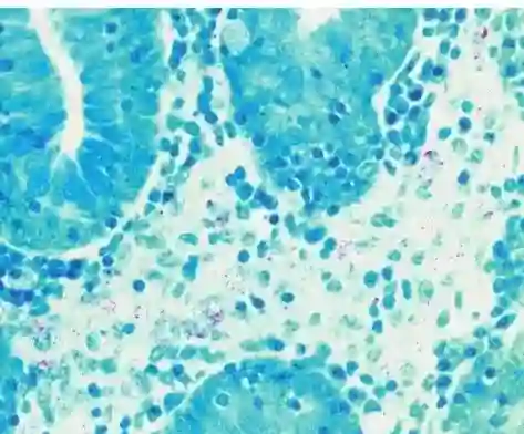 Acid-fast staining