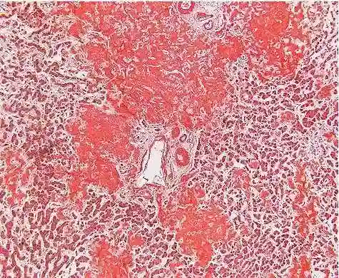 Amyloid substance
