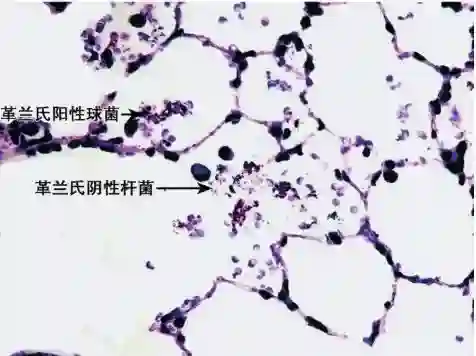 Bacterial staining