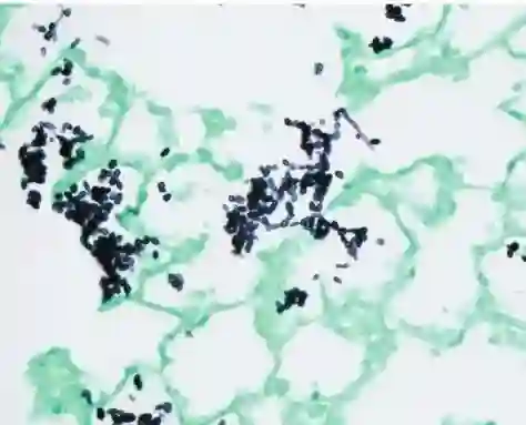 Fungal staining