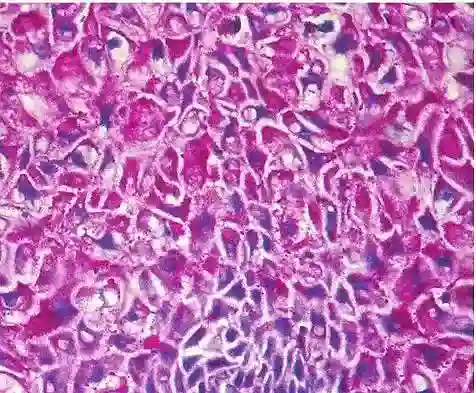 Glycogen staining