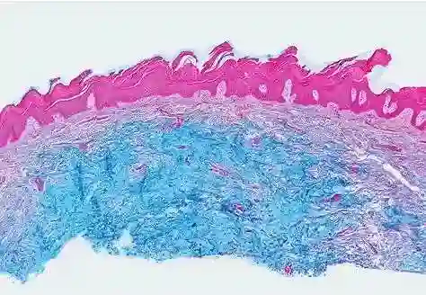 Mucous staining
