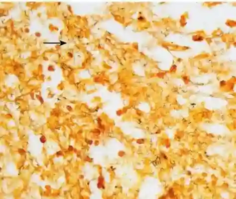 Spirochaeta staining