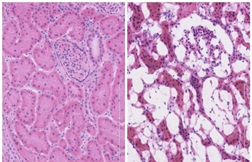 Kidney tissue