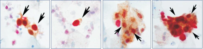 Applications of Multiplex Immunohistochemistry