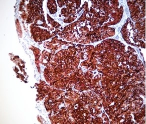 Scenarios for Chromogenic mIHC