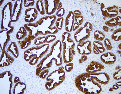 Primary Antibody Functions Explained Key Differences from Secondary Antibodies