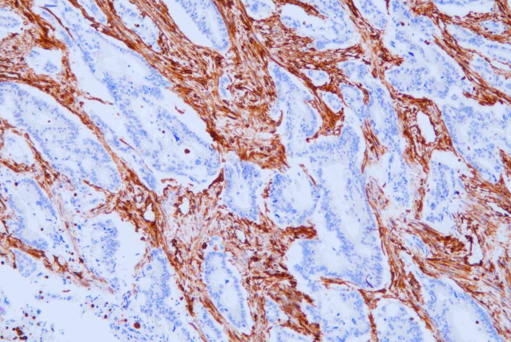 Vimentin(V9)
