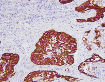 CK56p40 detection reagent