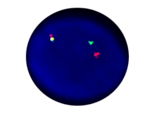 EVI Breakapart Detection Kit