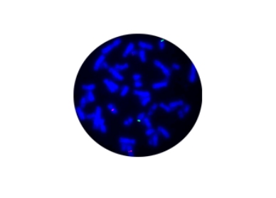 IGH Fusion Gene FISH Probe