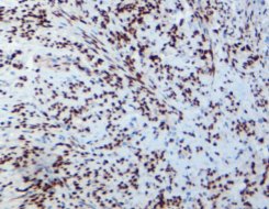 MicroStacker Plus Polymer Detection Kit