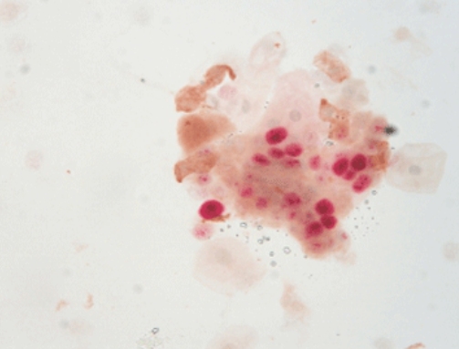 P16Ki-67 dual staining detection reagent kit (immunocytochemistry)