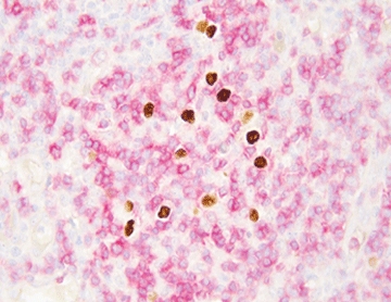 EBER IHC Dual Staining Kit