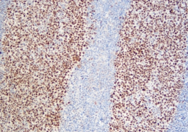 [Instrument-specific] MicroStacker™ Plus Polymer Detection Kit