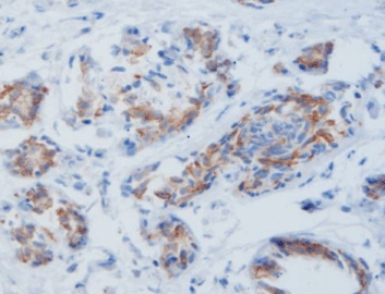 MicroStacker™ Flex Polymer Detection Kit