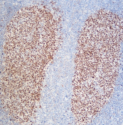 MicroStacker™ Plus Polymer Detection Kit