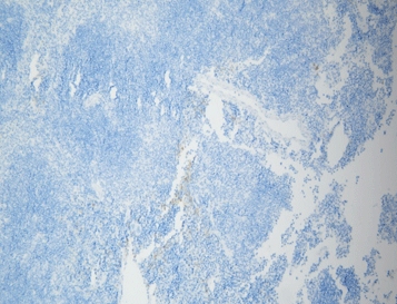 [RX] MicroStacker™ Mouse-on-Mouse HRP Polymer