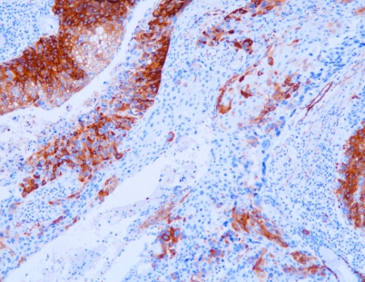 Smooth Muscle Myosin(C1B2),MMab