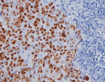 EBER CISH Probe (Automated)