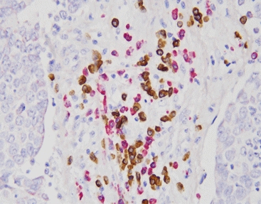 Kappa Lambda Probe Kit