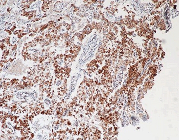 primary antibody SDHB(21A11AE7), MMab