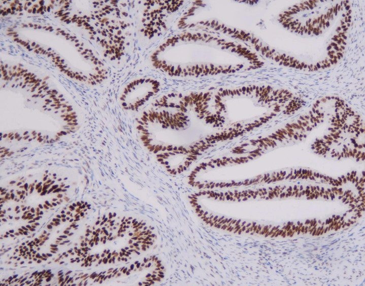 Automated MMR sets deliver fast, uniform results