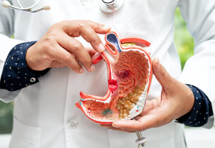 Comparing EBER ISH and EBV IHC for gastric cancer diagnosis