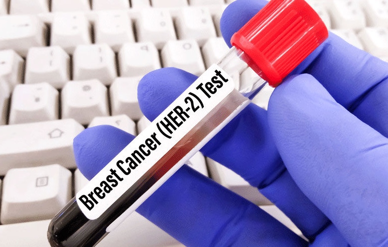 Distinguishing HER2-Low from HER2-Negative status