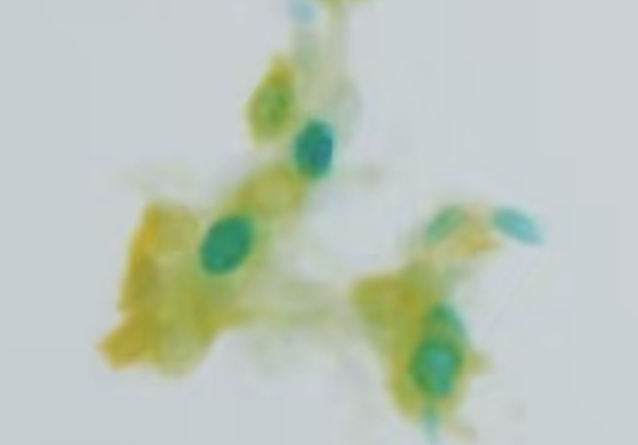 Dual-stained cells stand out plainly under the microscope