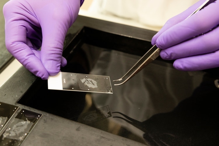 Limitations of Manual IHC in High-Volume Laboratories