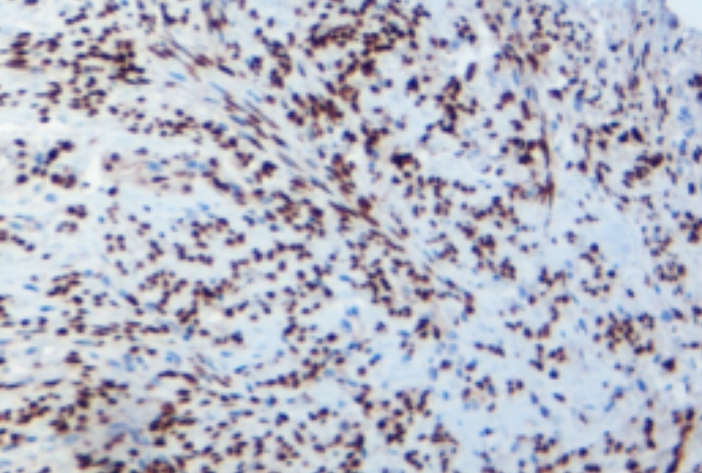 MicroStacker™ Plus Polymer Detection Kit offers a biotin-free option