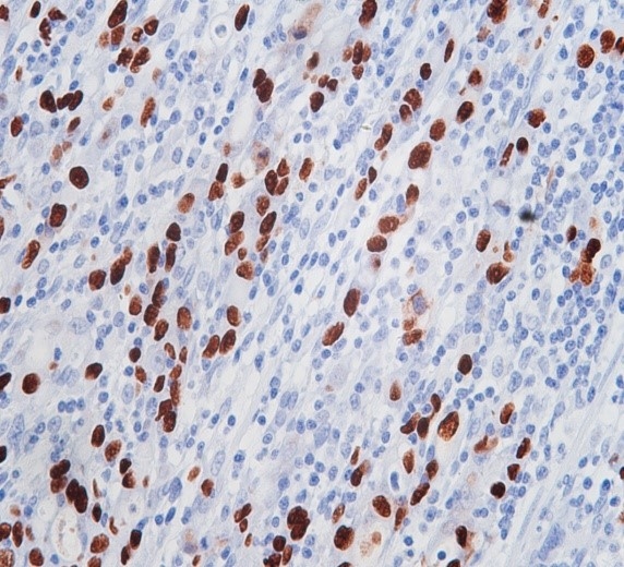 Precise single-molecule detection with EBER Probes