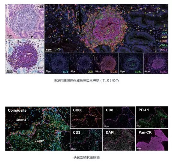 Multiplex Immunofluorescence(mIF) Kit