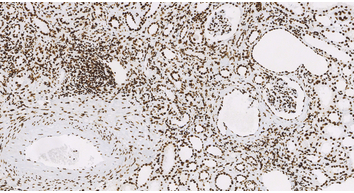 ARID1A(EPR13501),RMab