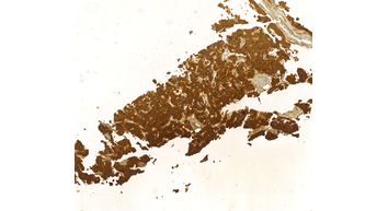 Calcitonin(MyM1-CT), MMab