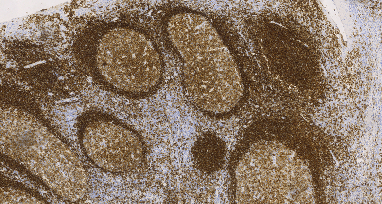 CD45RA(4KB5),MMab