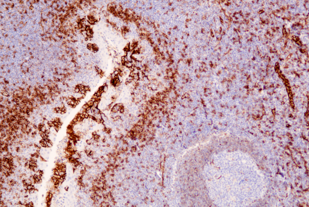 CD31(C6E5),MMab