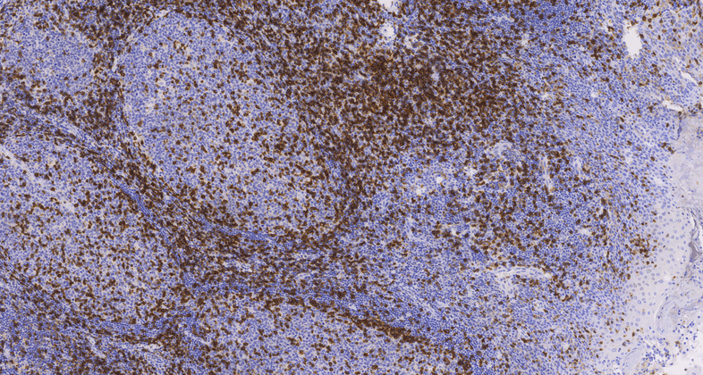 CD45RO(UCHL1),MMab