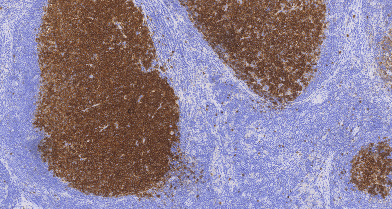 CD10(C6D1),MMab