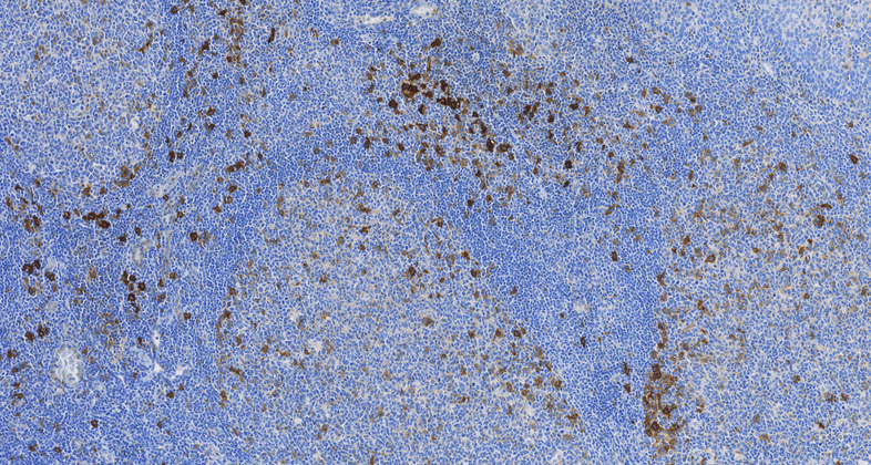 CD30(C5E10),MMab