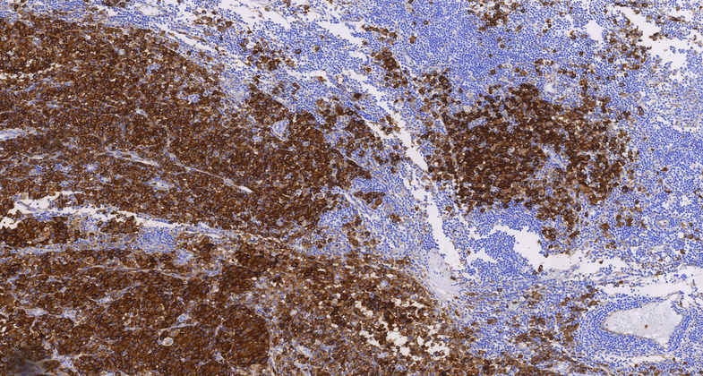CD63(NK1/C3),MMab