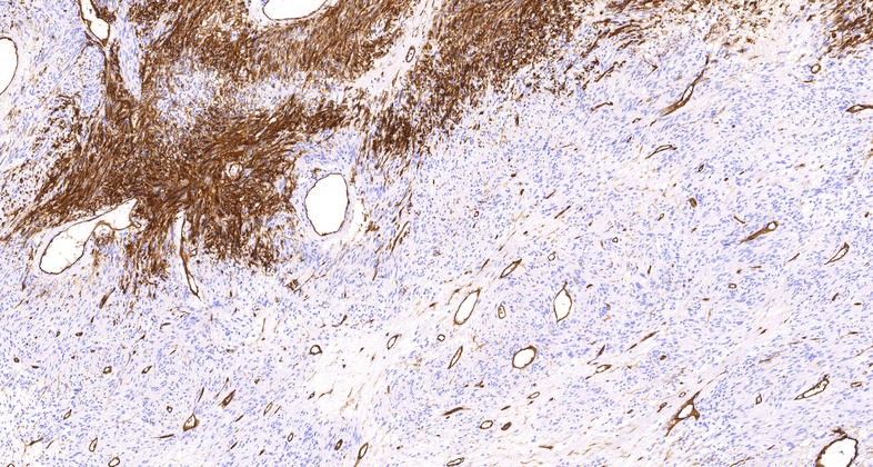 CD34(QBEnd/10), MMab