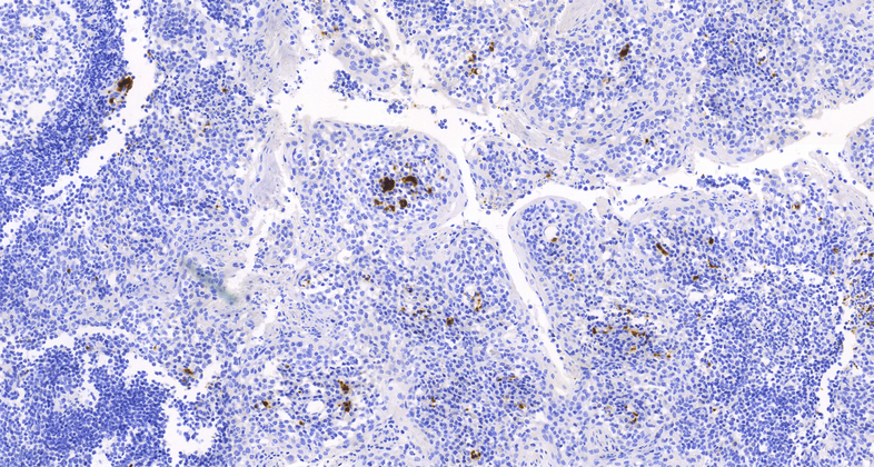 CD61 (MyM1-CD61),MMab