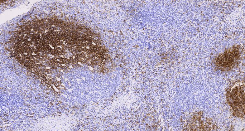 CD23 (C3B11), MMab