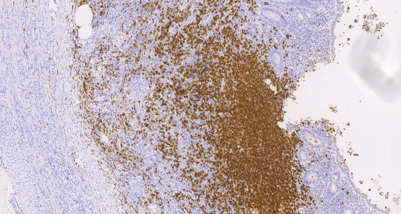 CD20(C4A11),MMab