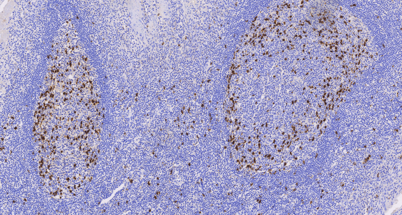 CD57(NK-1),MMab