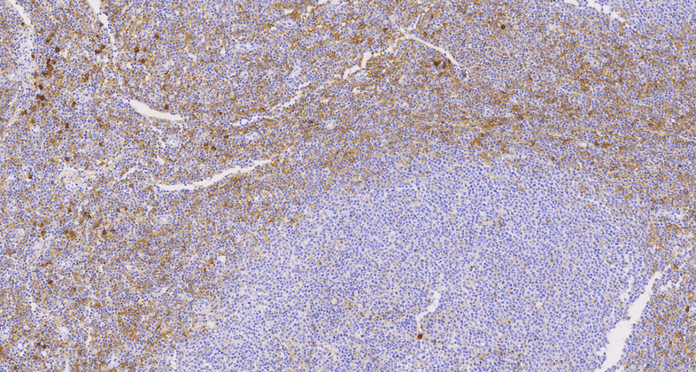 CD38 (C3G3), MMab